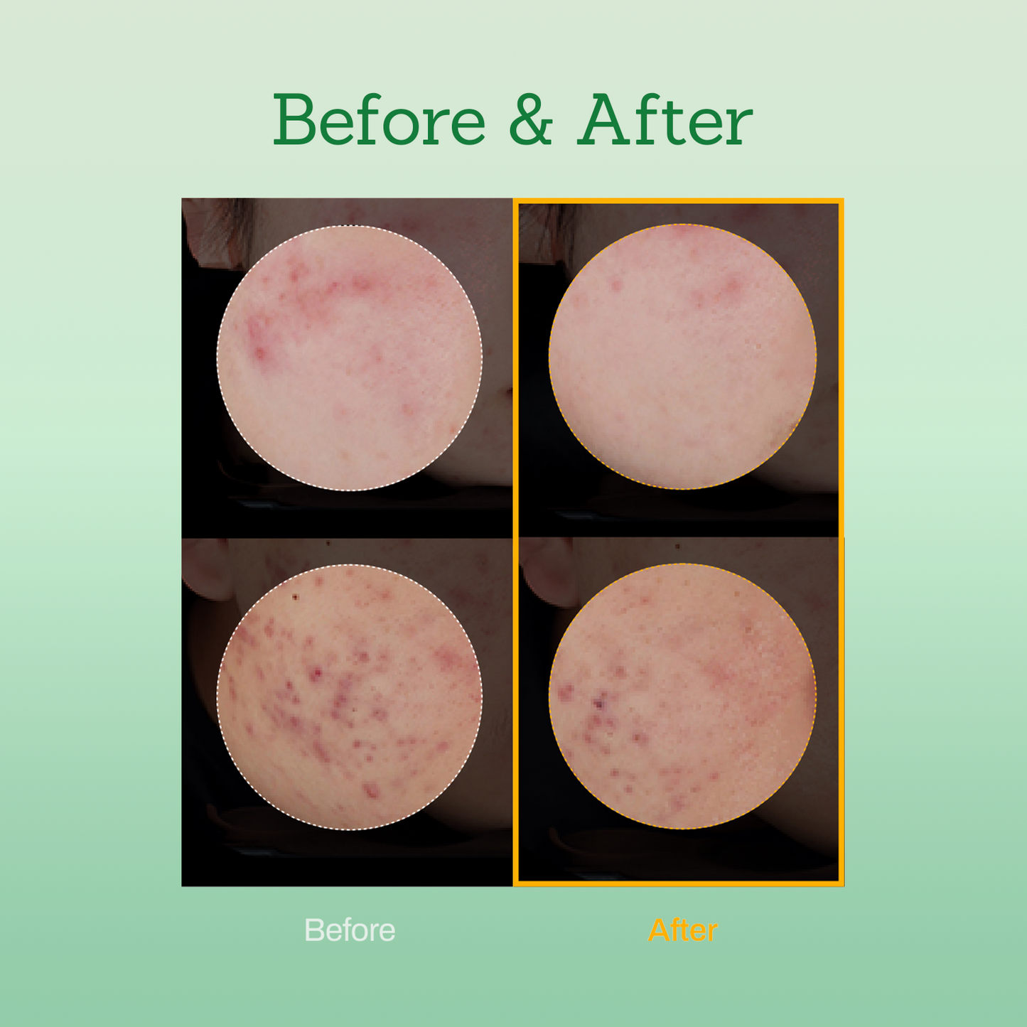 Mugwort Super Calming Toner + Serum + Jojoba Cream