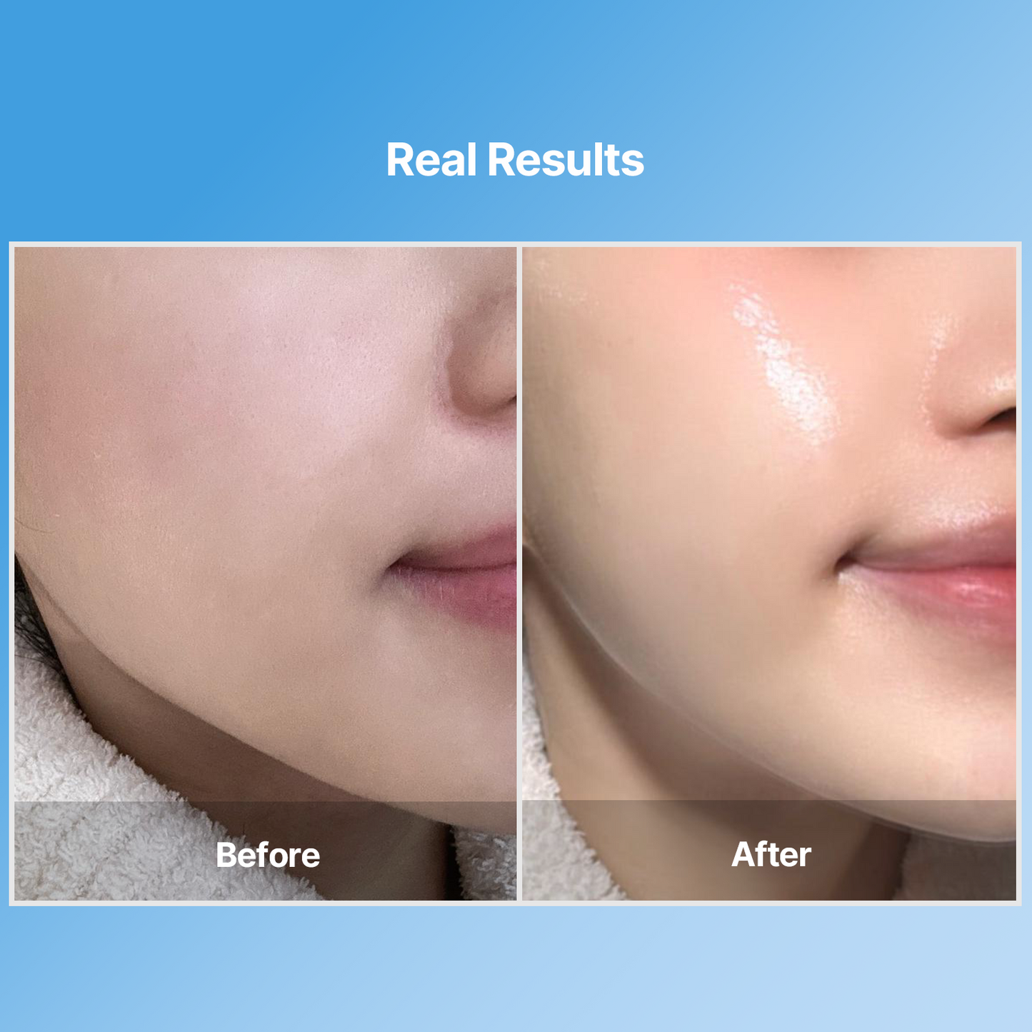 Bluelayer Water Dome Mask