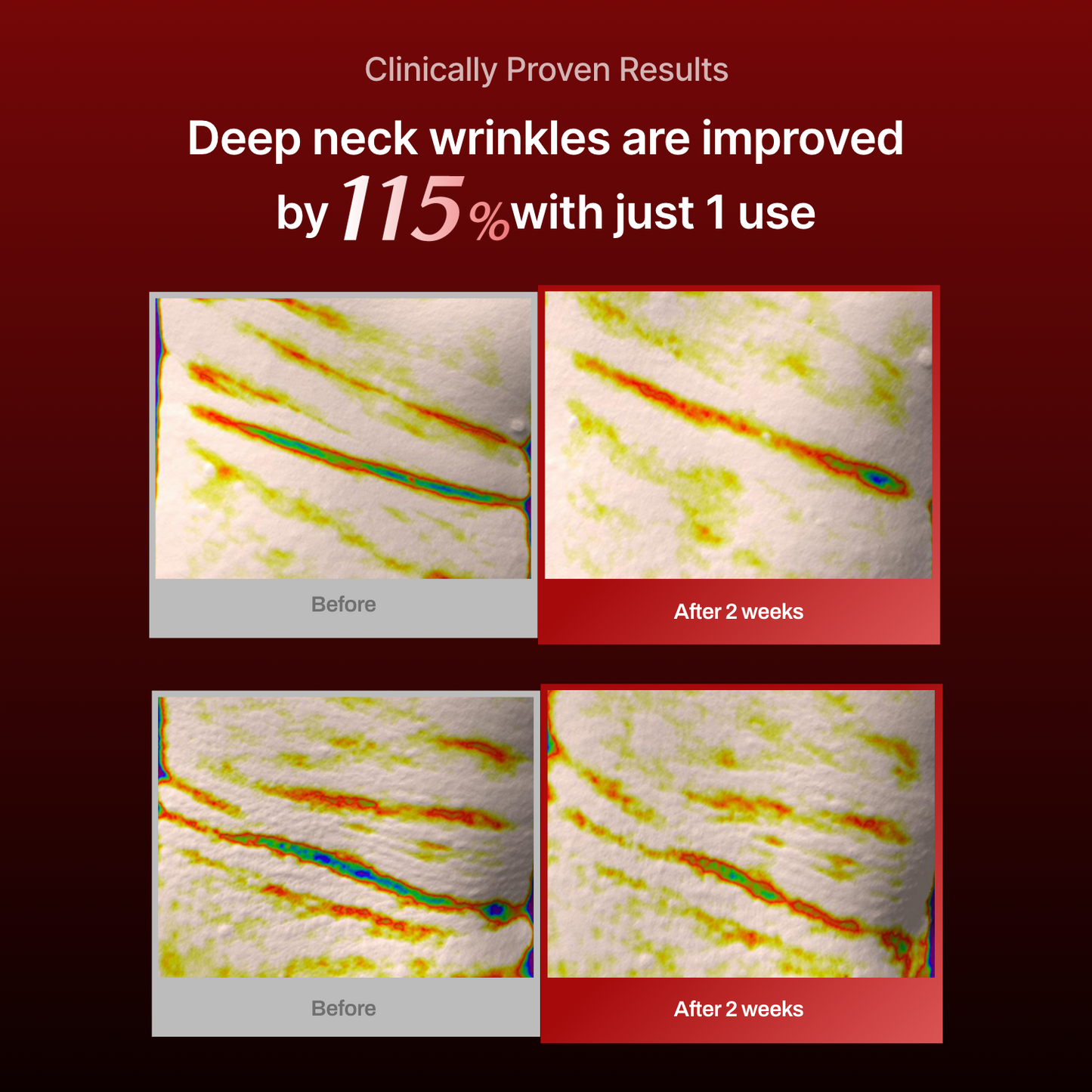 Collagen Wrinkle-fit Neck Mask
