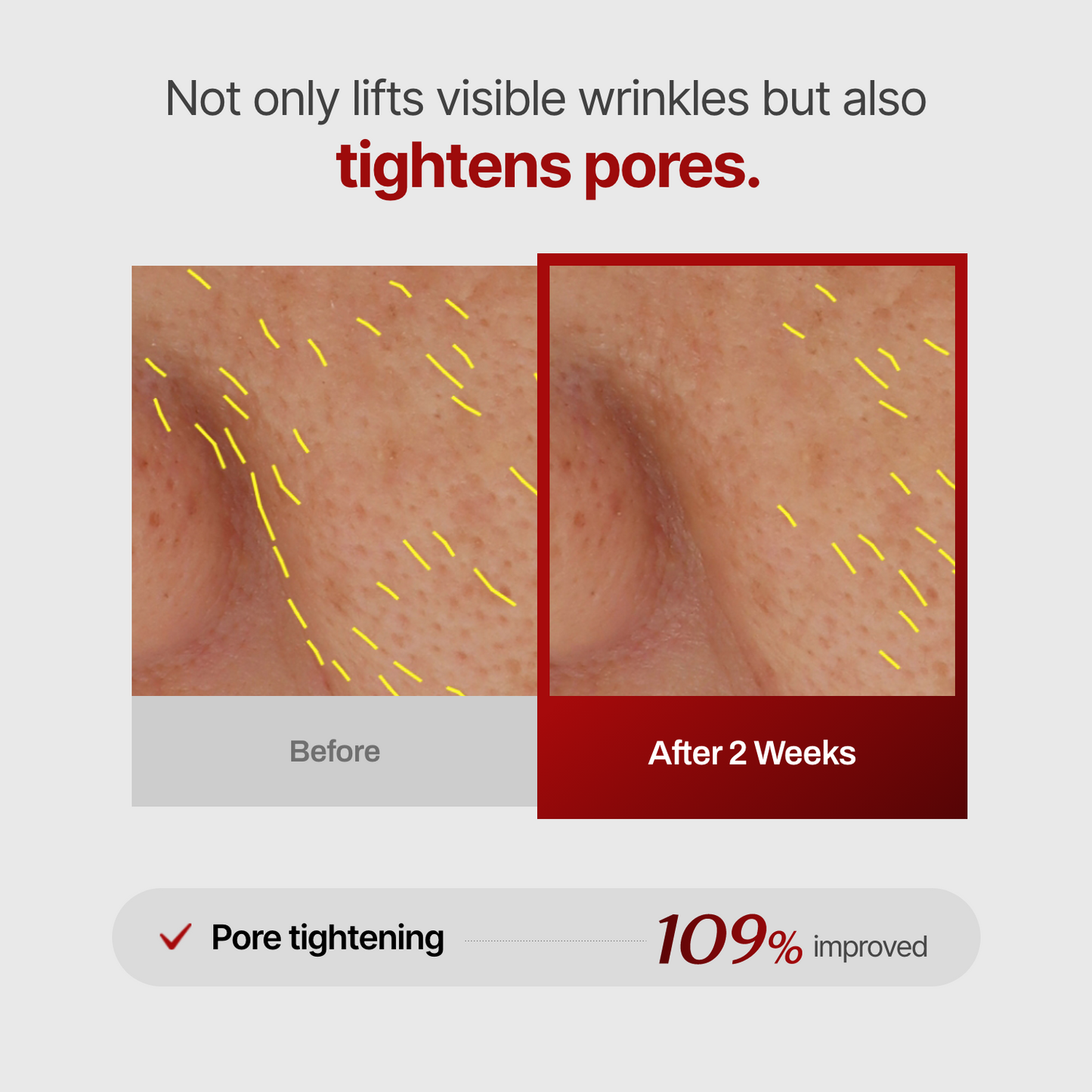 Collagen Wrinkle-fit Neck Mask