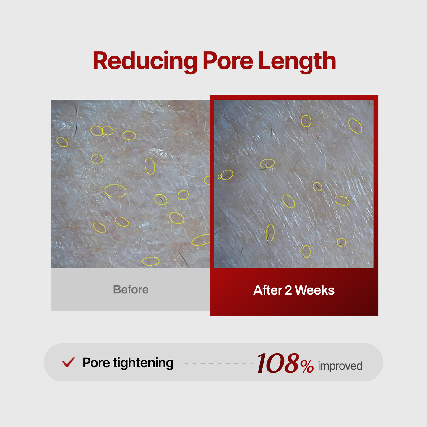 Collagen Wrinkle-fit Neck Mask