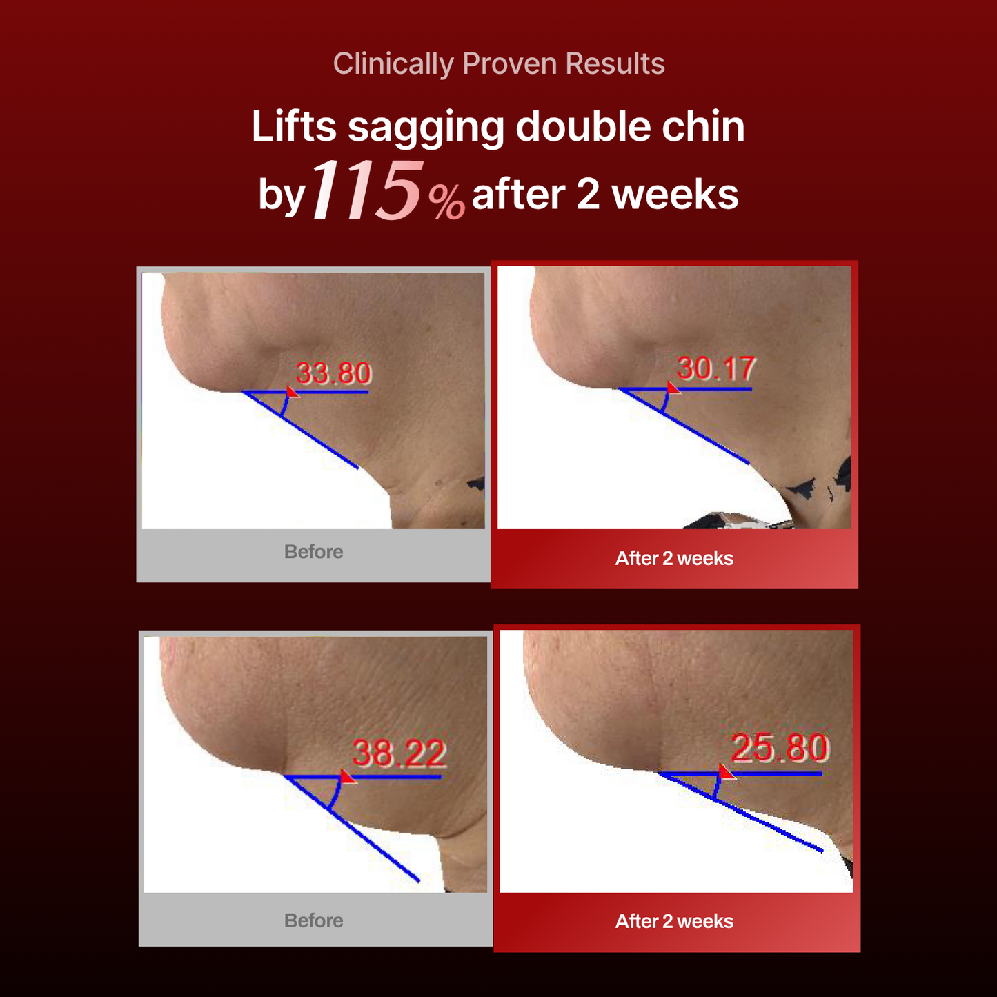 Collagen Wrinkle-fit Neck Mask