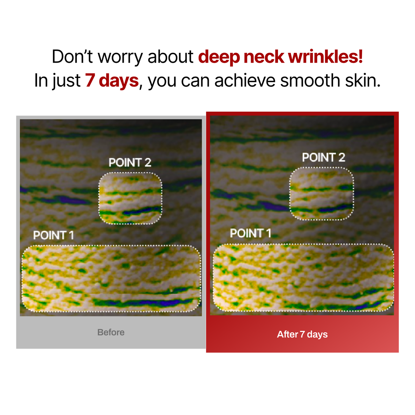 Collagen Wrinkle-fit Neck Mask