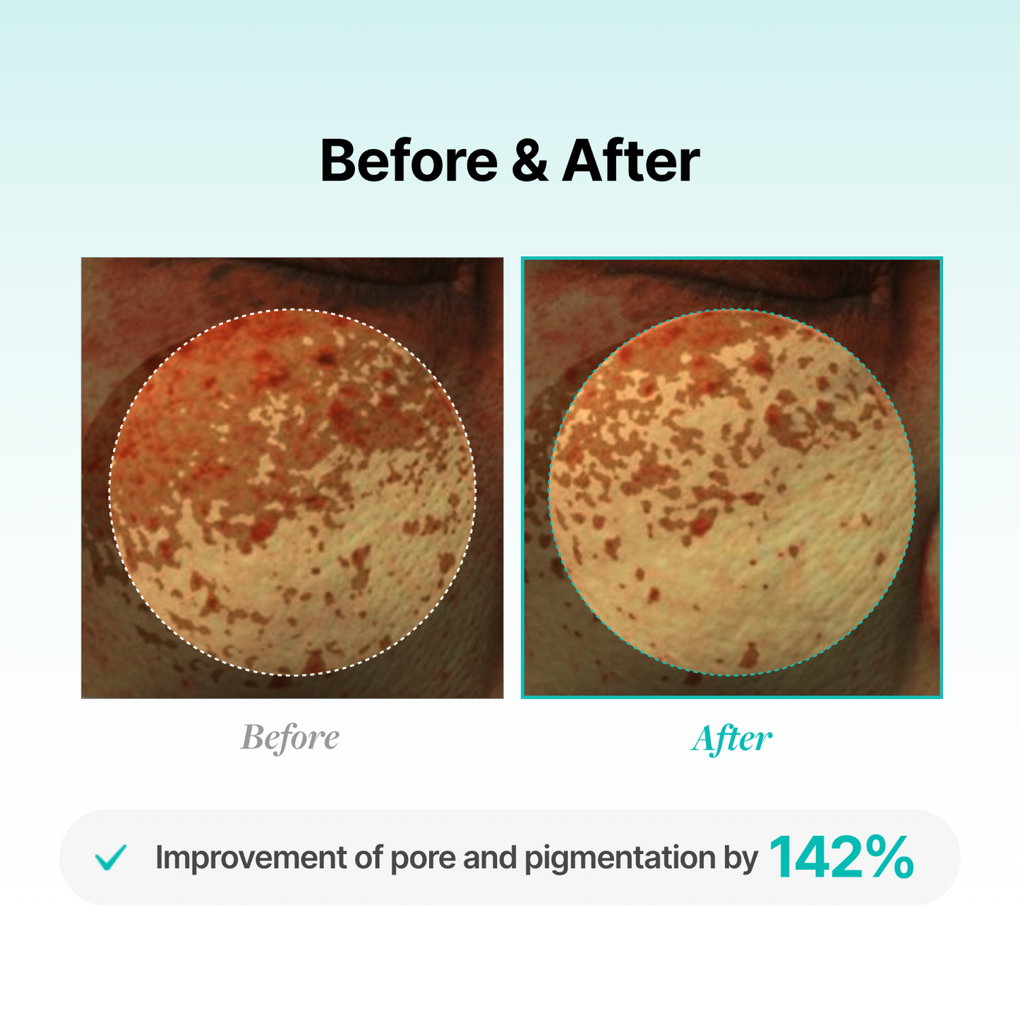 [Amazon] Porethera Real Bifida Blur Cream