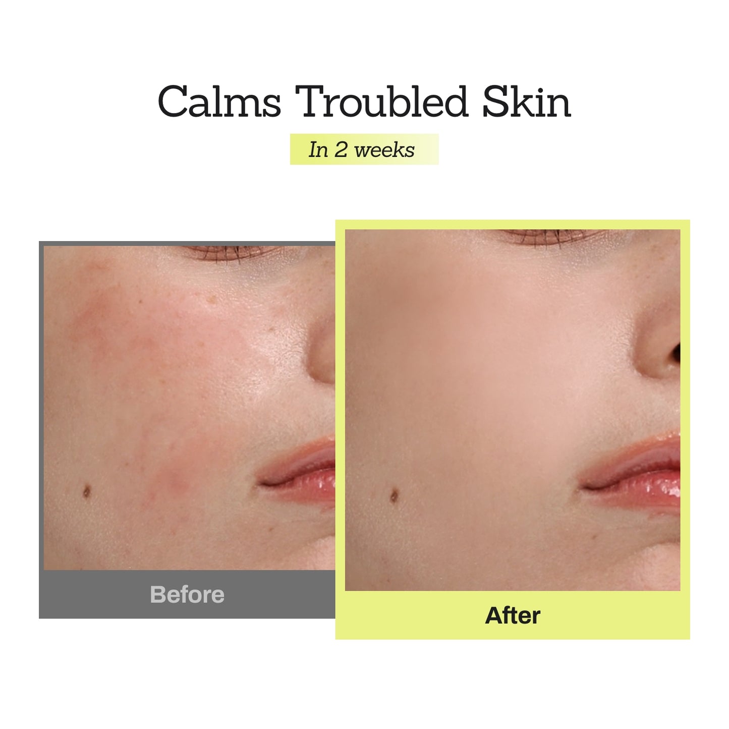 Mugwort Super Calming Toner + Serum + Centella Calming Cream