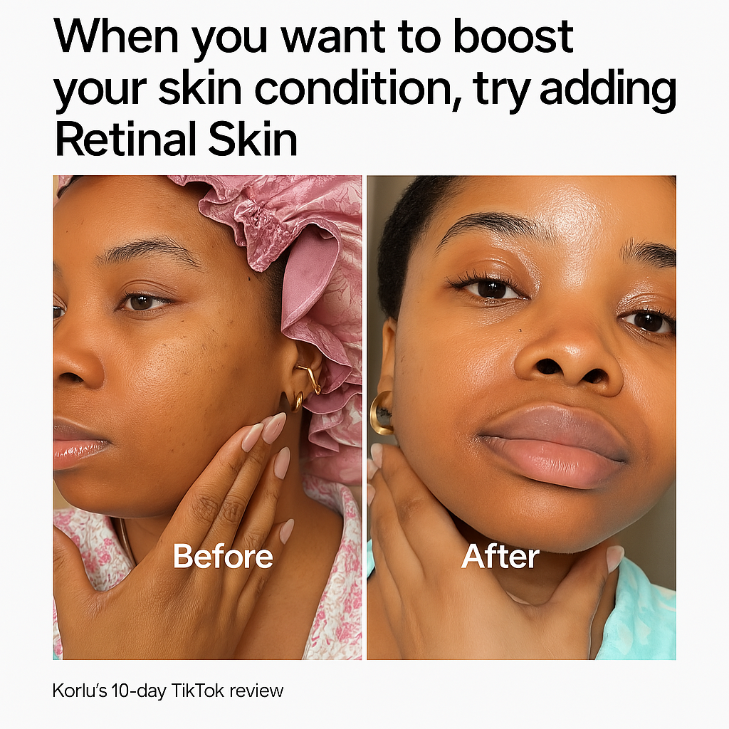 [Amazon Best Deal] Retinal Skin Booster Serum 44% Off