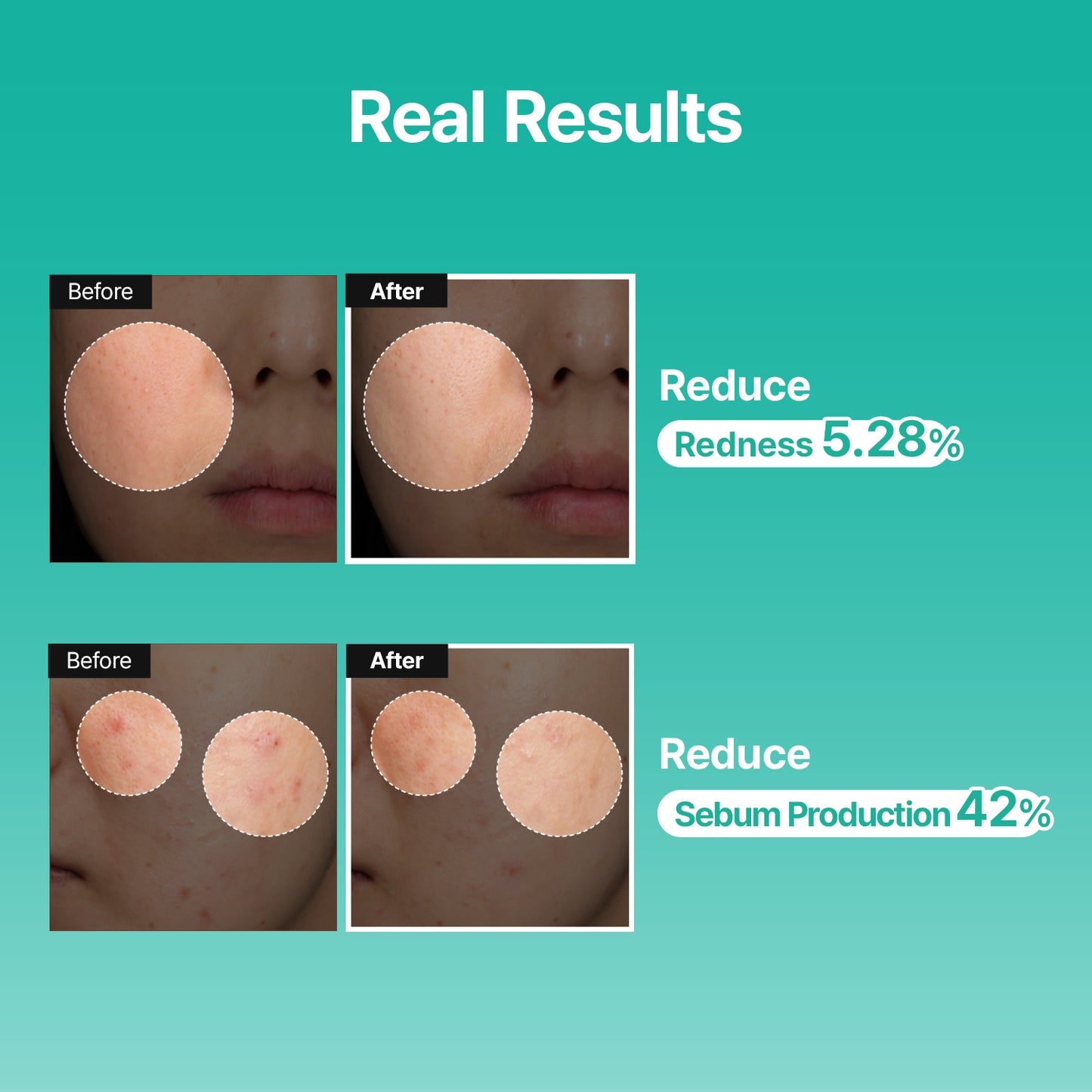 [BF Deal | 19.99] PDRN Cica Booster Serum – Centella PDRN & D-Panthenol – Redness Relief & Sensitive Skin Repair