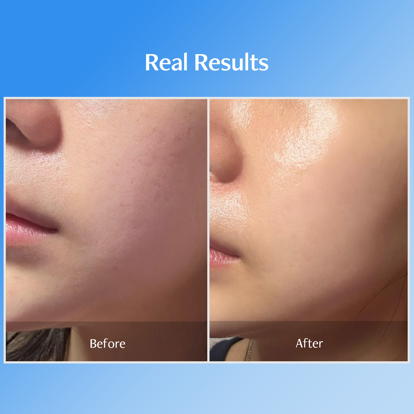 Bluelayer Ampoule Jet + Azulene Ampoule + Dome Mask + Water Cream