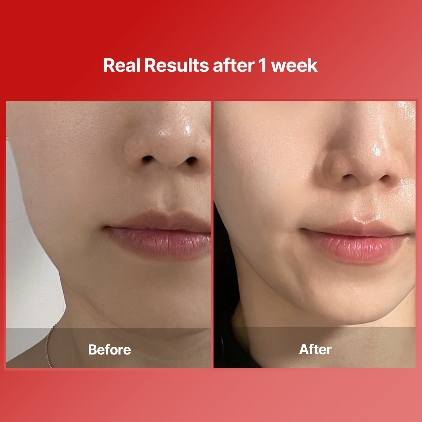 Shumage Gold Seal Cream + Device + Gold Seal Ampoule + Wrapping Mask
