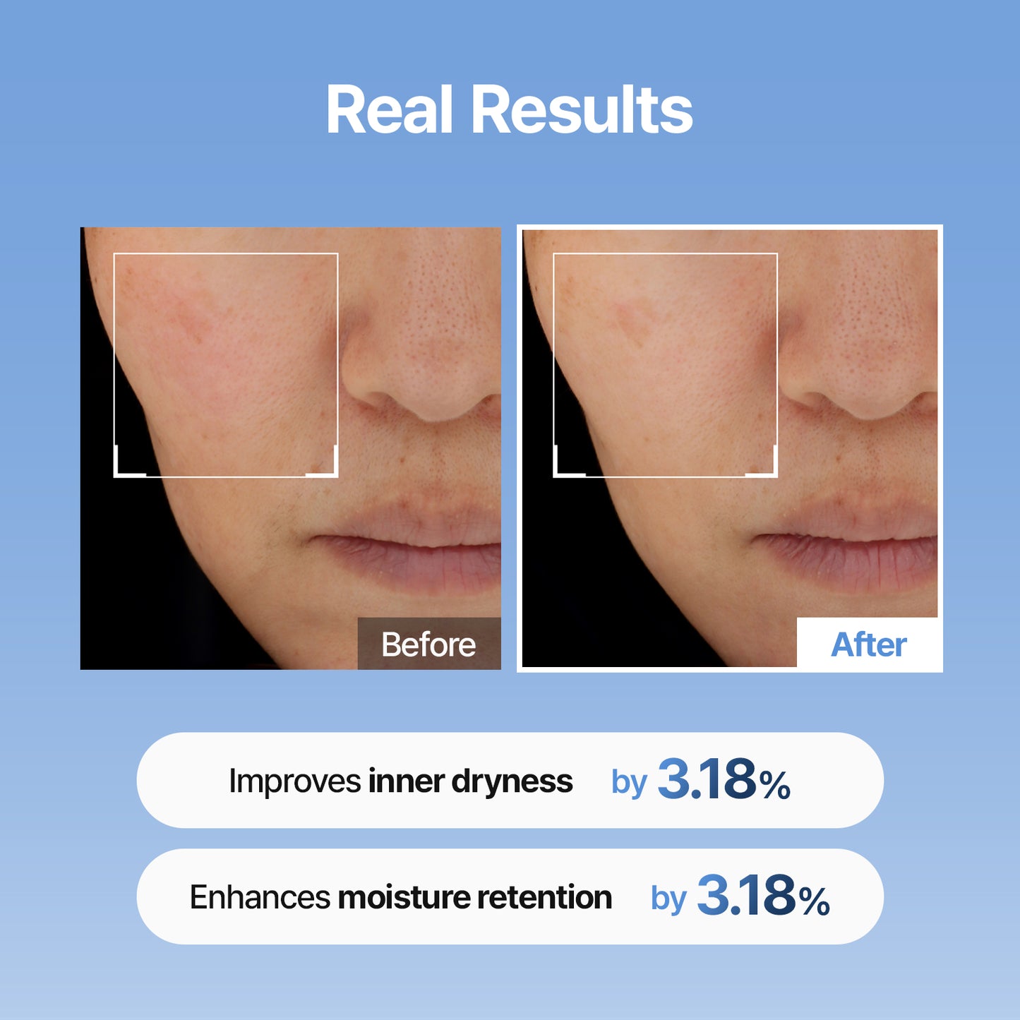 [NEW | $17.99] Hyaluronic Acid Skin Booster First Serum – 3 Pumps, Non-Sticky Glow Up