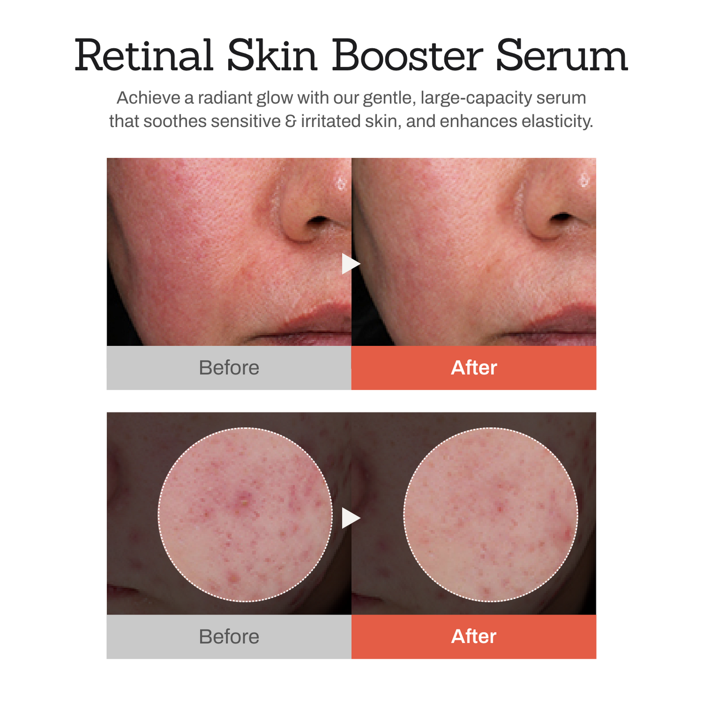 [Amazon] Retinal Skin Booster Serum 5.07 fl. oz