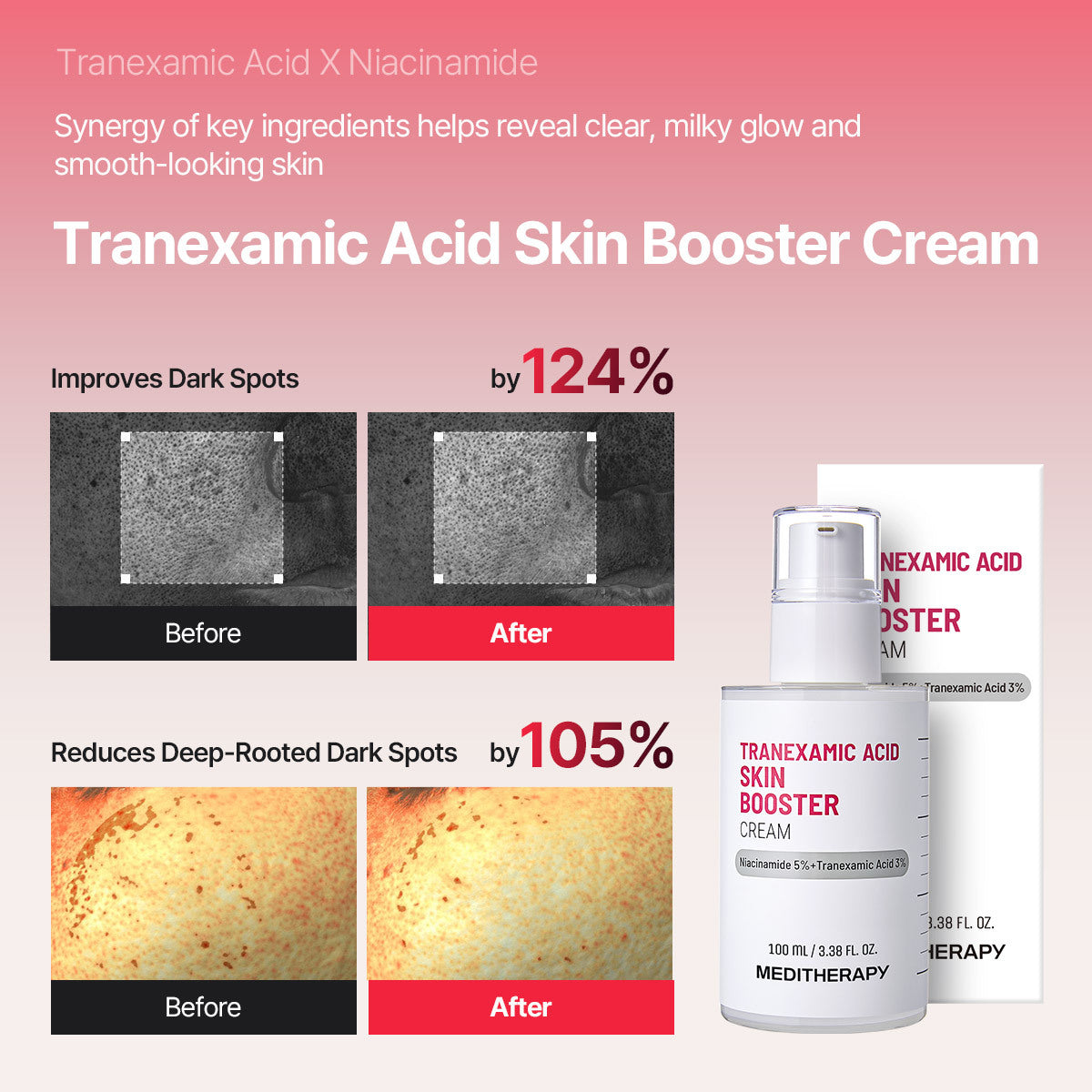 Dark Spot Reset Routine Set